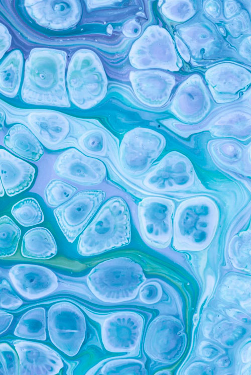 SVF (Fracción vascular estromal derivada de tejido adiposo)