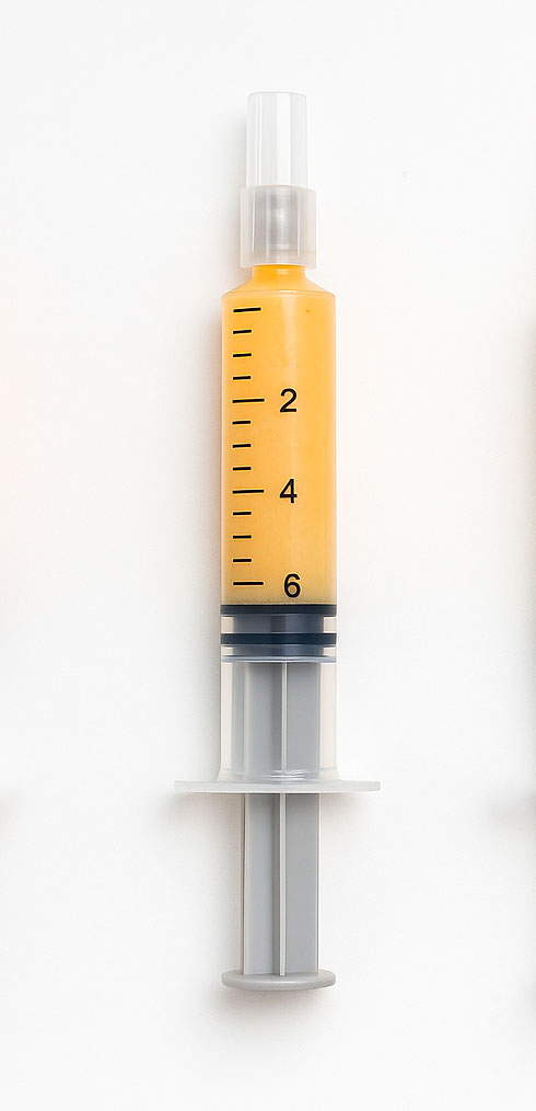 Nanofat (injerto adiposo micronizado)